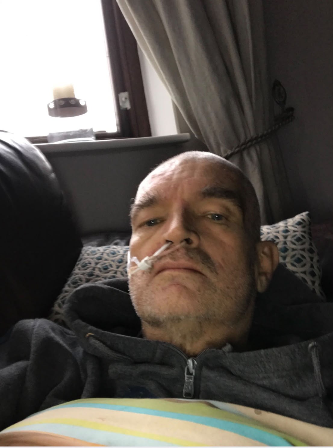 Brian lying back with a nasogastric feeding tube taped at his nose