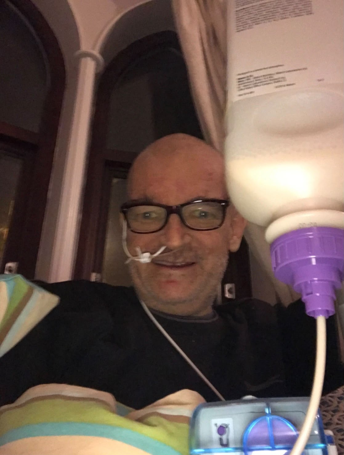 Brian with the nasogastric feeding tube bottle in place for 12-hour feeds
